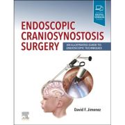 Endoscopic Craniosynostosis Surgery: An Illustrated Guide to Endoscopic Techniques