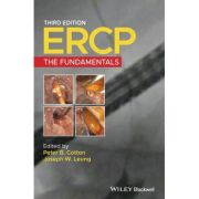 ERCP: Fundamentals