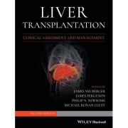 Liver Transplantation: Clinical Assessment and Management