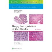 Biopsy Interpretation of the Bladder (Biopsy Interpretation Series)