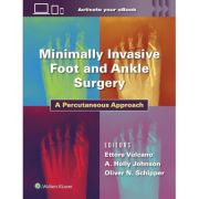Minimally Invasive Foot and Ankle Surgery: A Percutaneous Approach