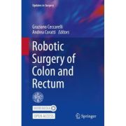 Robotic Surgery of Colon and Rectum (Updates in Surgery)