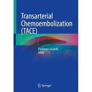 Transarterial Chemoembolization (TACE)