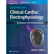 Josephson's Clinical Cardiac Electrophysiology: Techniques and Interpretations