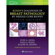 Rosen's Diagnosis of Breast Pathology by Needle Core Biopsy