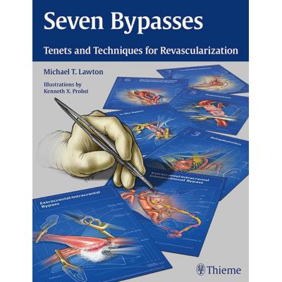 Seven Bypasses
