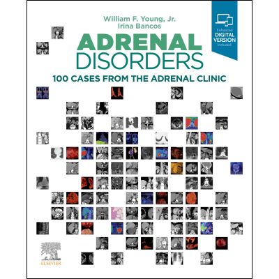 Adrenal Disorders: 100 Cases from the Adrenal Clinic